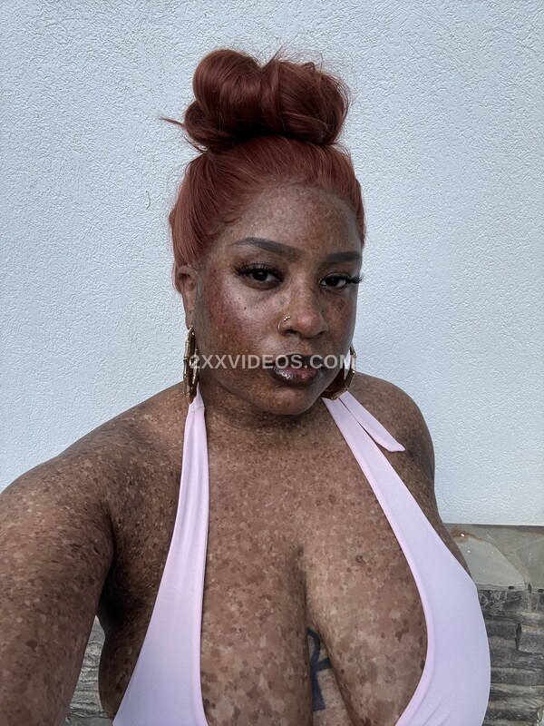freckled47 photo