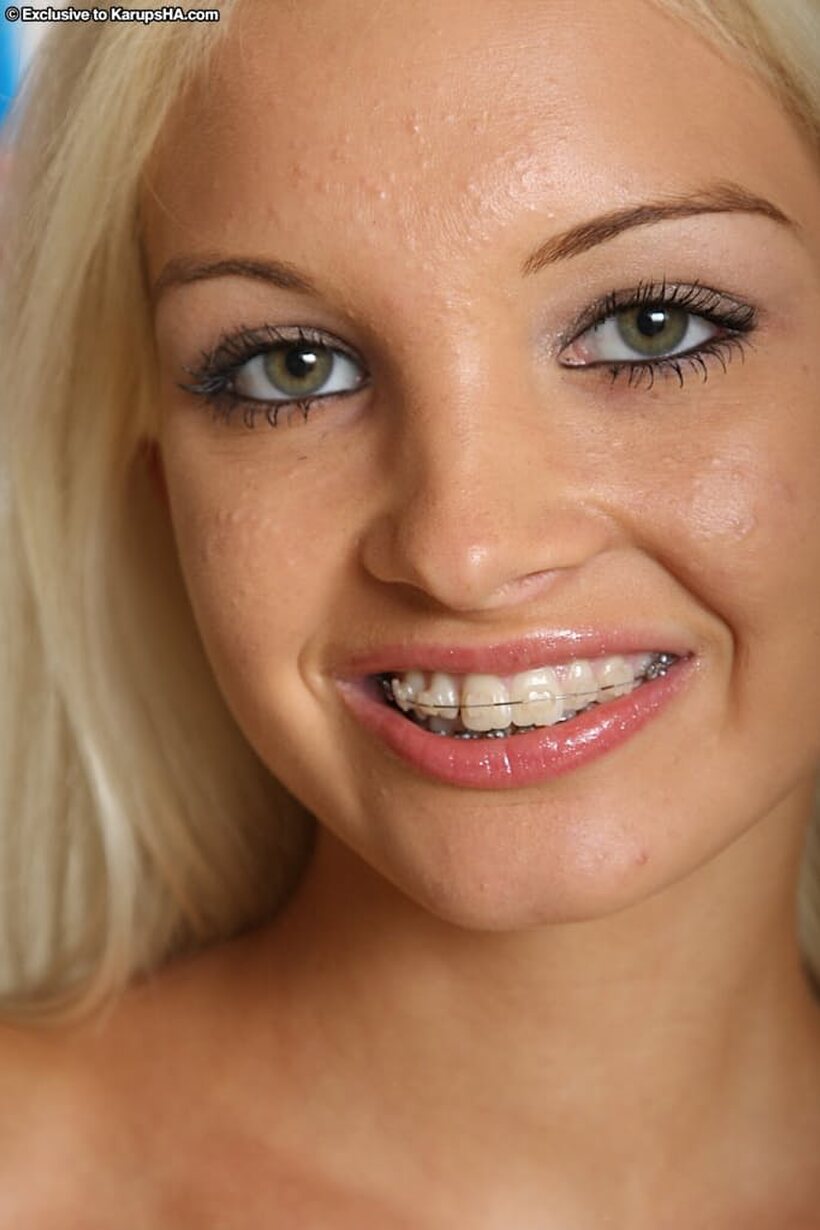 Photo 15 — Braces and panties frame a barely legal blonde posing solo