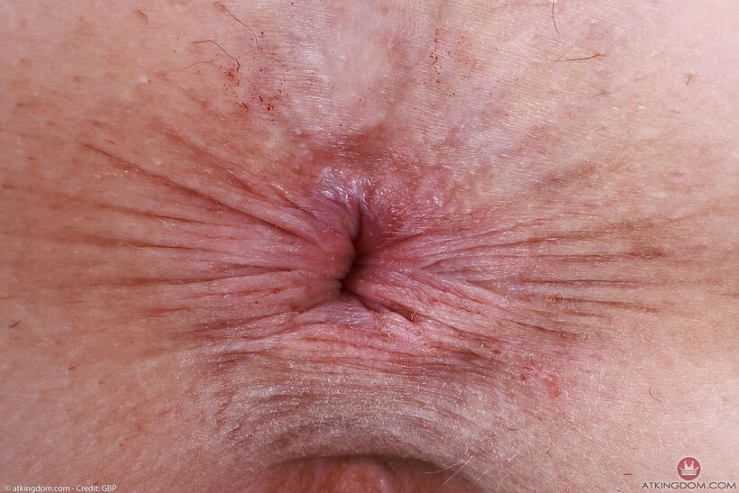Photo 21 — Hairy Stella Nash poses with her gaping asshole on display in glasses