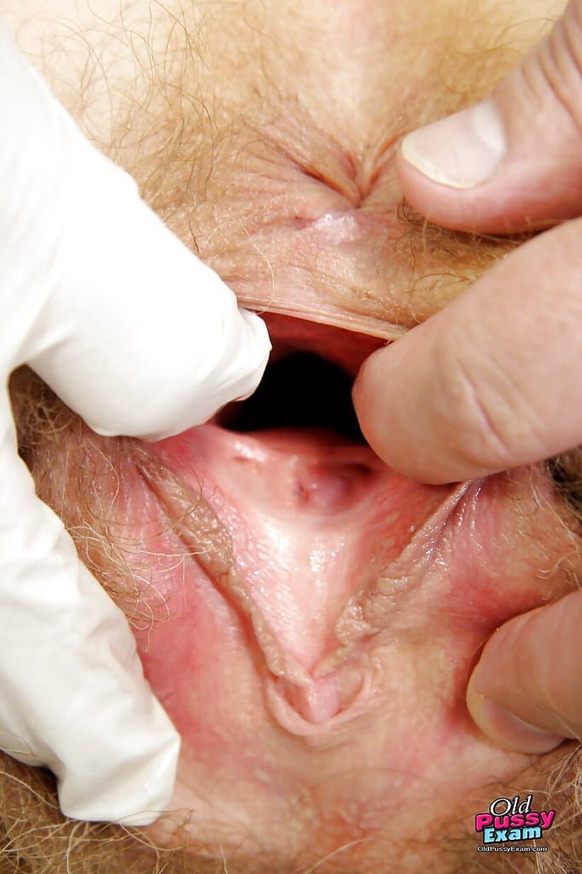Big Clit pic 7 from the set «Gyno toys with a mature brunette’s hairy twat exam»